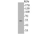 Cytokeratin 14 Antibody in Western Blot (WB)