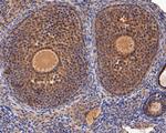 ERK2 Antibody in Immunohistochemistry (Paraffin) (IHC (P))