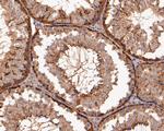 ERK2 Antibody in Immunohistochemistry (Paraffin) (IHC (P))