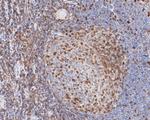 CD43 Antibody in Immunohistochemistry (Paraffin) (IHC (P))