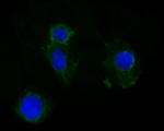 Cytokeratin 19 Antibody in Immunocytochemistry (ICC/IF)