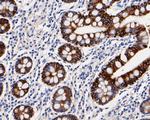 Cytokeratin 19 Antibody in Immunohistochemistry (Paraffin) (IHC (P))