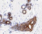 Cytokeratin 19 Antibody in Immunohistochemistry (Paraffin) (IHC (P))