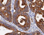 Cytokeratin 19 Antibody in Immunohistochemistry (Paraffin) (IHC (P))