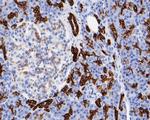 Cytokeratin 19 Antibody in Immunohistochemistry (Paraffin) (IHC (P))