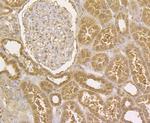 Integrin beta 1 Antibody in Immunohistochemistry (Paraffin) (IHC (P))