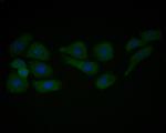 Caveolin-1 Antibody in Immunocytochemistry (ICC/IF)