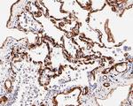 Caveolin-1 Antibody in Immunohistochemistry (Paraffin) (IHC (P))