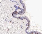CD1A Antibody in Immunohistochemistry (Paraffin) (IHC (P))
