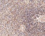 CD22 Antibody in Immunohistochemistry (Paraffin) (IHC (P))