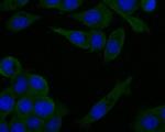 ZAP70 Antibody in Immunocytochemistry (ICC/IF)