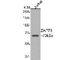 ZAP70 Antibody in Western Blot (WB)