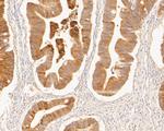 MUC1 Antibody in Immunohistochemistry (Paraffin) (IHC (P))