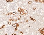 MUC1 Antibody in Immunohistochemistry (Paraffin) (IHC (P))