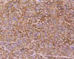 CD166 Antibody in Immunohistochemistry (Paraffin) (IHC (P))