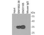 Myc-tag Antibody in Immunoprecipitation (IP)