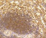 CD19 Antibody in Immunohistochemistry (Paraffin) (IHC (P))