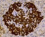 Insulin Antibody in Immunohistochemistry (Paraffin) (IHC (P))