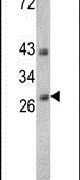 ENDOG Antibody in Western Blot (WB)