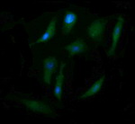 ENG Antibody in Immunocytochemistry (ICC/IF)