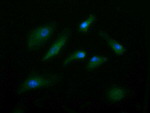 ENG Antibody in Immunocytochemistry (ICC/IF)