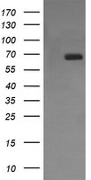 ENG Antibody in Western Blot (WB)