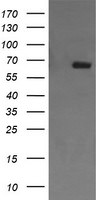 ENG Antibody in Western Blot (WB)