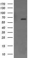 ENG Antibody in Western Blot (WB)