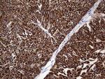 ENKUR Antibody in Immunohistochemistry (Paraffin) (IHC (P))