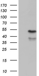 ENTPD1 Antibody in Western Blot (WB)