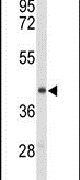 ENTPD2 Antibody in Western Blot (WB)