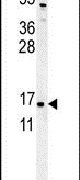 ENY2 Antibody in Western Blot (WB)