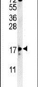 ENY2 Antibody in Western Blot (WB)