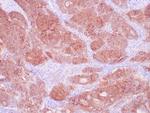 EP-CAM / ESA Antibody in Immunohistochemistry (Paraffin) (IHC (P))