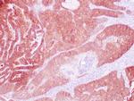 EP-CAM / ESA Antibody in Immunohistochemistry (Paraffin) (IHC (P))
