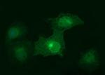 EPCAM Antibody in Immunocytochemistry (ICC/IF)