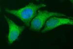 EPCAM Antibody in Immunocytochemistry (ICC/IF)