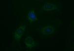 EPCAM Antibody in Immunocytochemistry (ICC/IF)