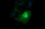 EPCAM Antibody in Immunocytochemistry (ICC/IF)