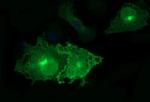 EPCAM Antibody in Immunocytochemistry (ICC/IF)