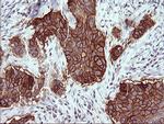 EPCAM Antibody in Immunohistochemistry (Paraffin) (IHC (P))