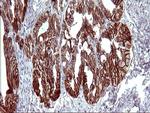EPCAM Antibody in Immunohistochemistry (Paraffin) (IHC (P))
