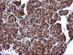 EPCAM Antibody in Immunohistochemistry (Paraffin) (IHC (P))