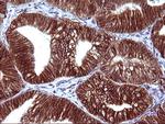 EPCAM Antibody in Immunohistochemistry (Paraffin) (IHC (P))