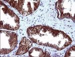 EPCAM Antibody in Immunohistochemistry (Paraffin) (IHC (P))