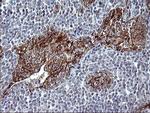 EPCAM Antibody in Immunohistochemistry (Paraffin) (IHC (P))