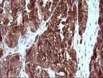 EPCAM Antibody in Immunohistochemistry (Paraffin) (IHC (P))