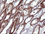 EPCAM Antibody in Immunohistochemistry (Paraffin) (IHC (P))