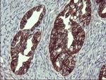 EPCAM Antibody in Immunohistochemistry (Paraffin) (IHC (P))