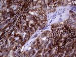 EPCAM Antibody in Immunohistochemistry (Paraffin) (IHC (P))